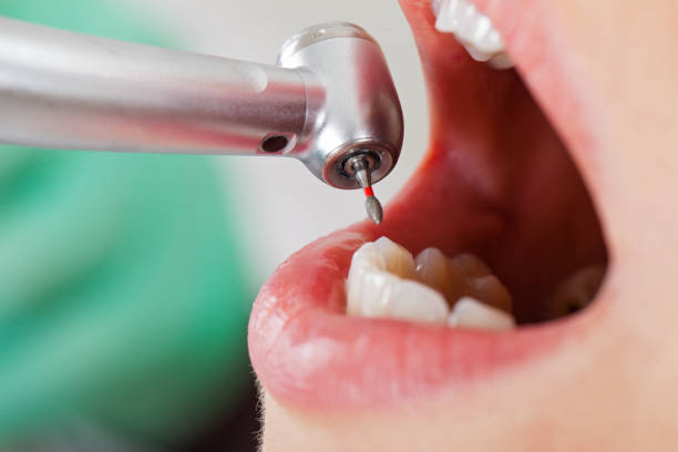Best Emergency Root Canal Treatment in Battle Creek, NE
